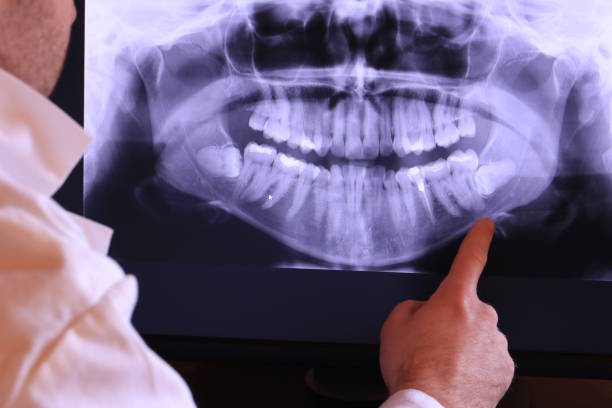 Best Emergency Dental Surgery in Schuyler, NE